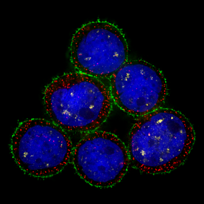 MDA-MB-453 human breast cancer cells