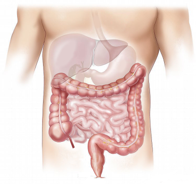 Drawing of the intestines and colon