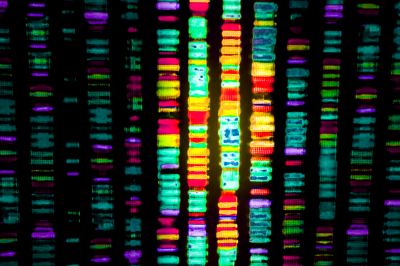 Analytical tool predicts genes that can cause disease by producing altered proteins